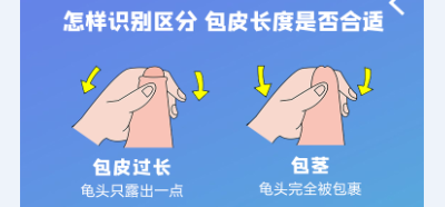 结石治疗常识